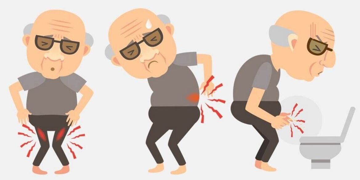 příznaky prostatitidy